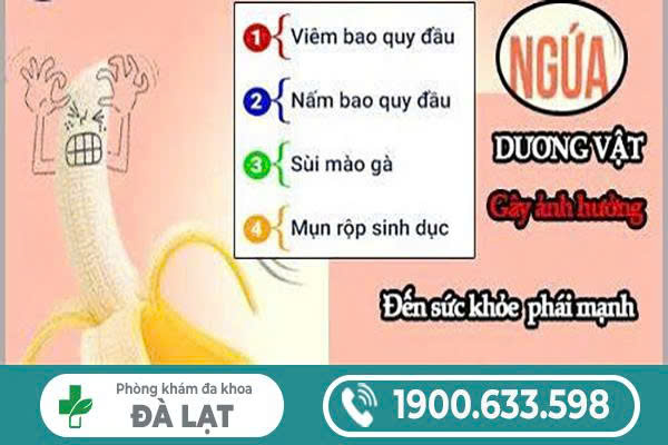 Hình ảnh minh họa